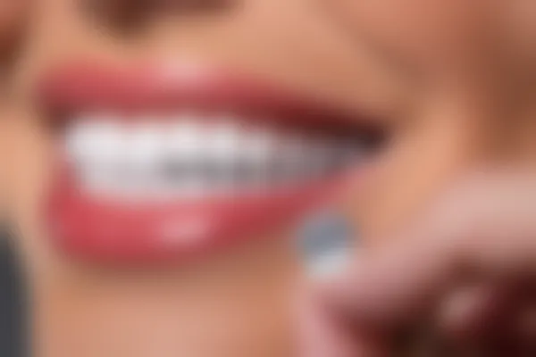 洗牙的方法有哪些，哪种方式为有效？