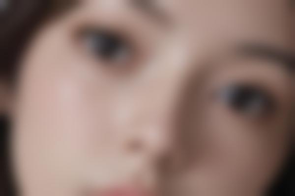 江阴曹志金眼鼻整形与面部年轻化修复怎么样？自然微创审美绝了！