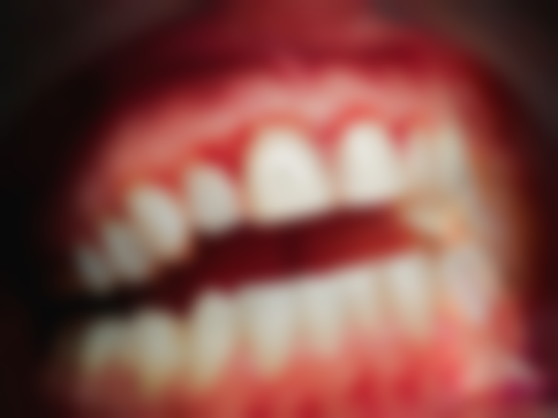 儿童牙疼与根管治疗