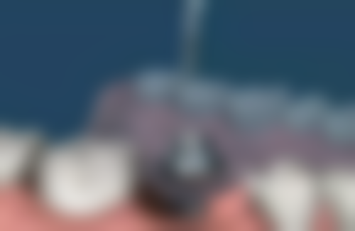 田涛医生擅长项目