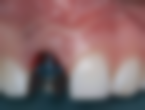 曲靖卓美口腔门诊部特色项目及技术优势