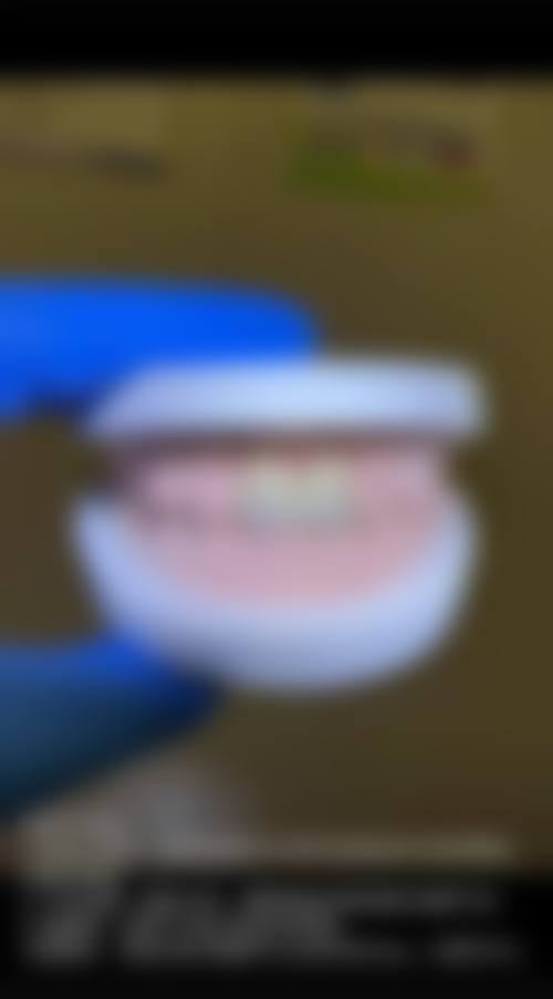 {广州圣贝口腔看牙技术很可靠，有孙世尧等大咖医生坐诊，超声波洁牙68-128元超划算！ 