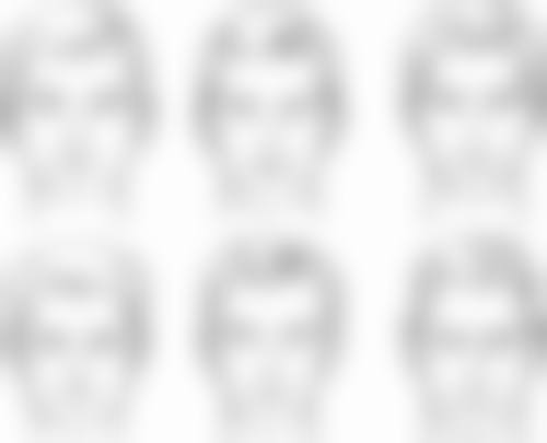 济南聚美整形医疗美容诊所真人口碑评价怎么样？