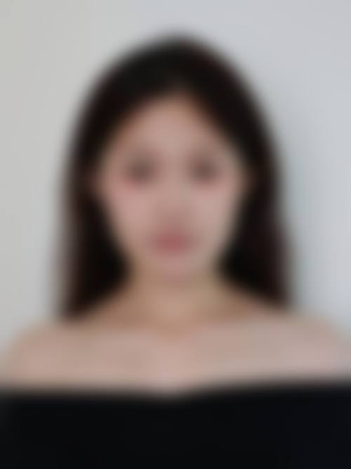 成都艾尔建医疗美容诊所价格表/收费标准