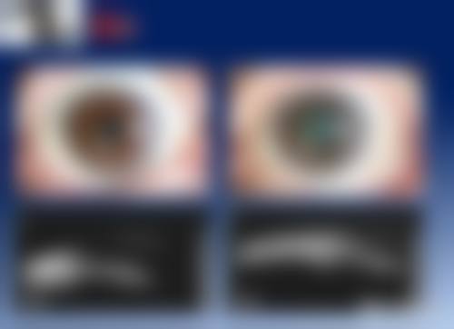 南阳市第一人民医院眼科特色项目及技术优势