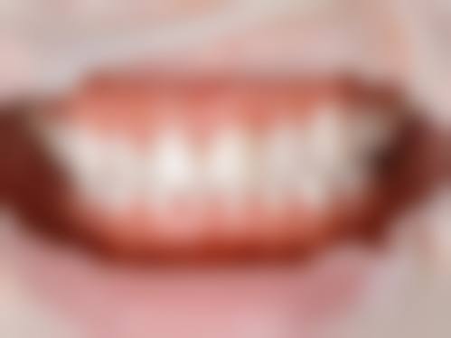 长沙米子君口腔门诊部价格表/收费标准