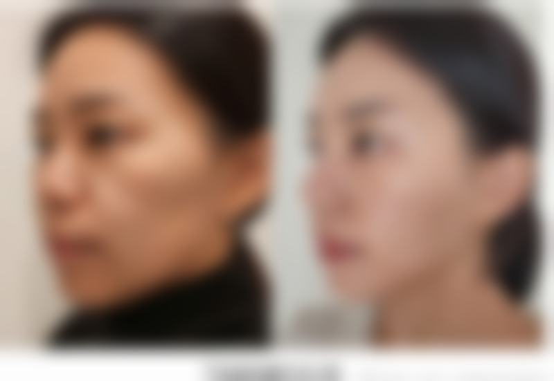 成都艾尔建医疗美容诊所特色项目及技术优势