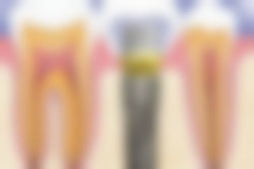 牙克石市雅康口腔特色项目及技术优势