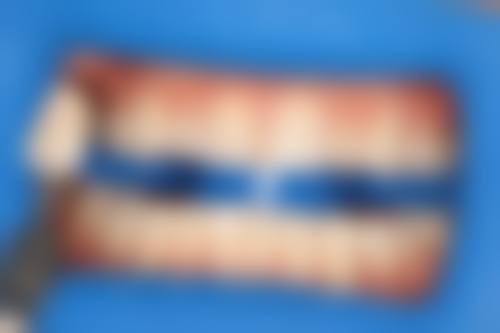 牙克石市雅康口腔详细的预约挂号方式及流程