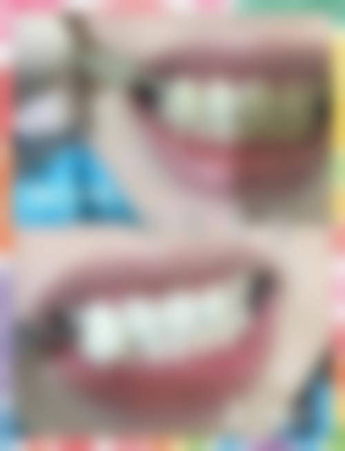 宿州市立医院陈德南医生专长