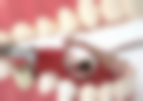 综合治疗改善地包天脸型