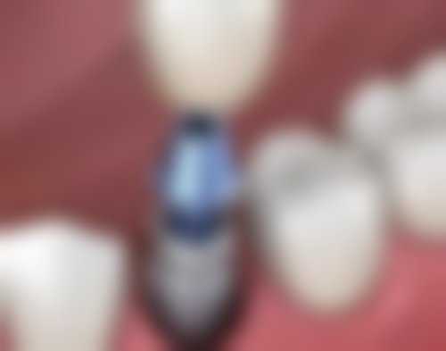 茂名市美雅口腔是正规医院吗？