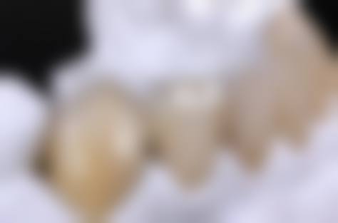 暨南大学附属第一医院口腔医疗中 心地址电话营业时间