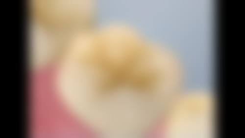 衡水24小时牙科：夜间急诊的贴心保护