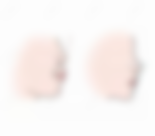 牙齿着色情况下洗牙