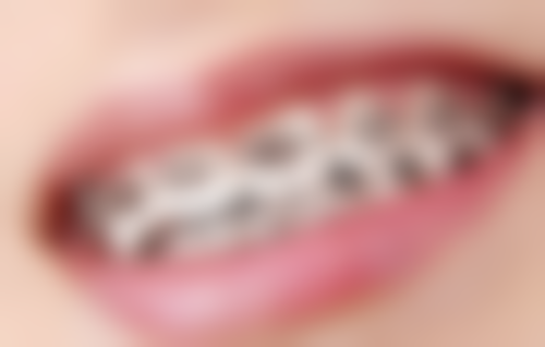 牙痛的时候能拔牙吗？解析三种必须拔牙的紧急情况及拔牙风险与决策要点