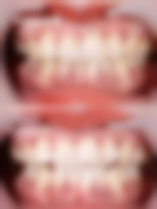 上海邦缔口腔真人口碑评价怎么样？