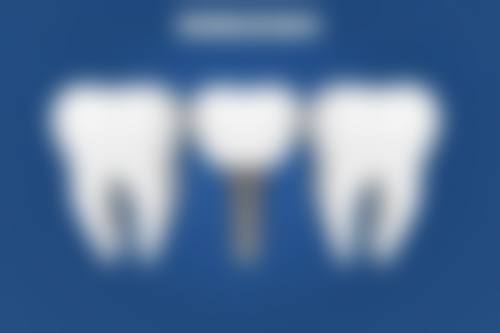 拔牙后药物使用注意事项