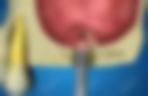 技术亮点：精良技术，种牙正畸显神通