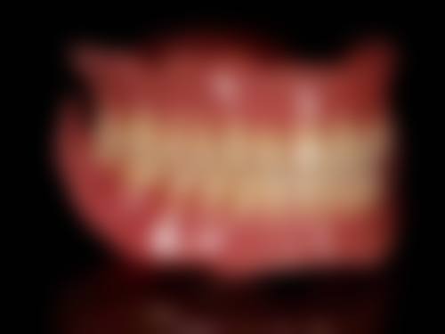 洗牙时使用洁牙头的注意事项