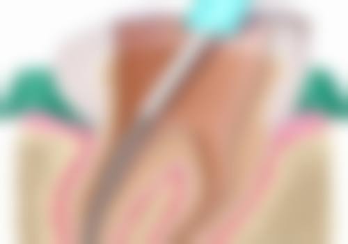 无锡江阴菁华口腔门诊部是正规医院吗？