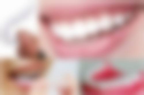 种植技术对全口种植牙费用的影响