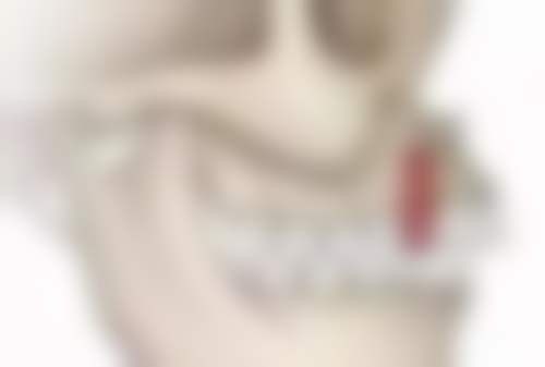 全瓷牙和烤瓷牙哪个？从美观性、耐用性及预算维度教你选适配的修复方案