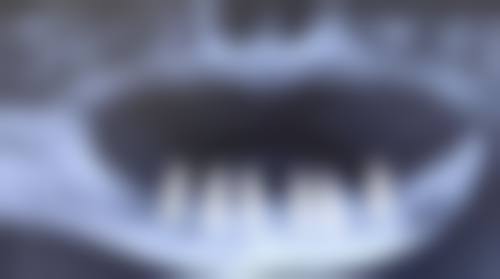 荣昌何朝阳口腔诊所真人口碑评价怎么样？