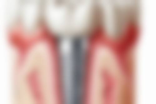 深圳一诚家庭口腔是正规医院吗？