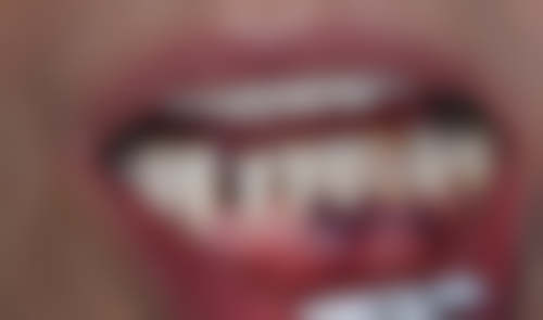 成都郫都立木口腔门诊部特色项目及技术优势