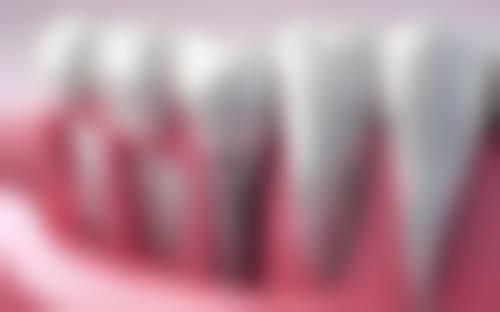 王大凯医生技术优势