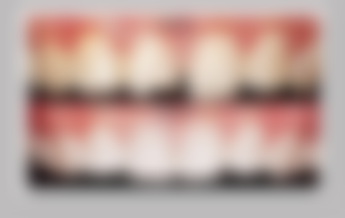 患者配合程度对补牙时间的影响