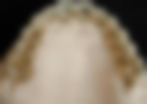 {抚州镶牙在线咨询24小时！抚州医学院附口腔镶牙价透明，全瓷牙600起，半口义齿4800起！ 