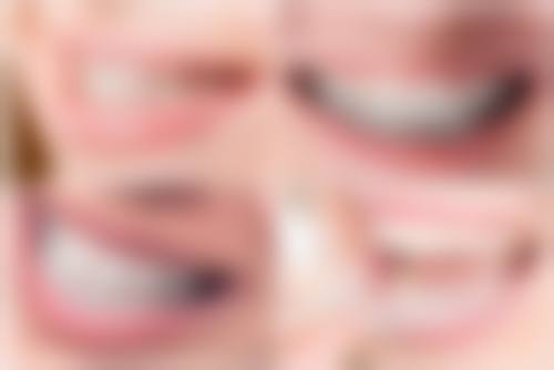 不同补牙材料对时间的影响