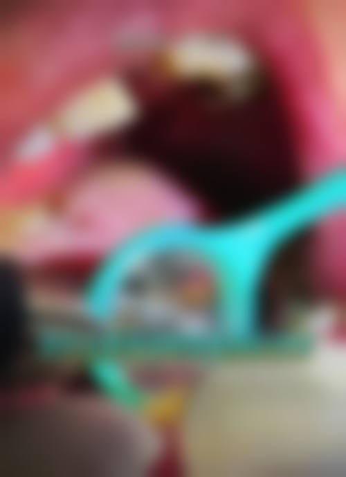 南京木子严口腔价格表/收费标准