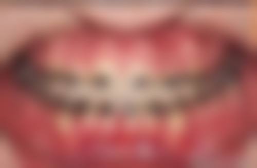 保山腾冲德博口腔：经验医生多，金属矫正价格优