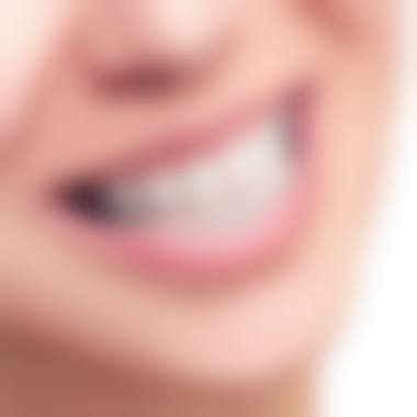 其他值得推荐的隐形矫正医院