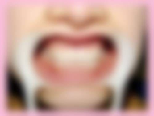 抚州市临川区人民医院口腔科：镶牙技术全方面之选