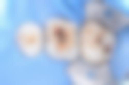 天津医 科 大学口腔医院常见项目价格