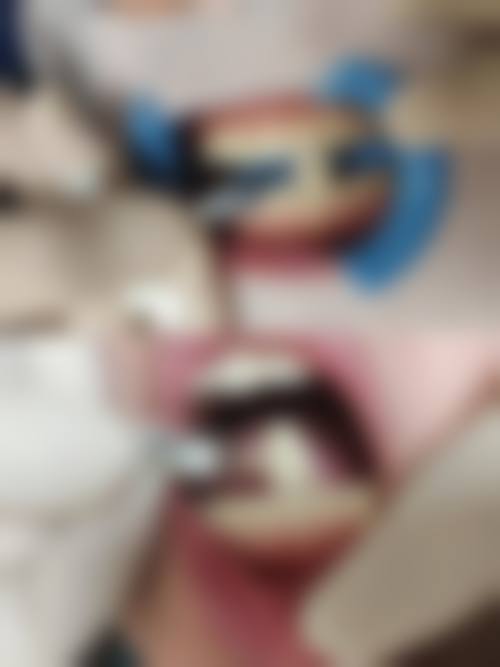 山西太原时代天使口腔真人口碑评价怎么样？