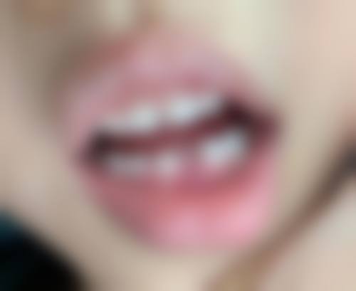 三、个性化方案定制，呵护每个孩子口腔健康