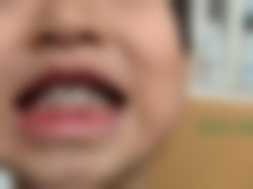 四、科普教育同步，提升家长口腔保健意识