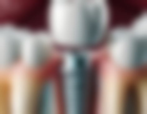 巴彦淖尔市魏宝成口腔诊所地址电话营业时间