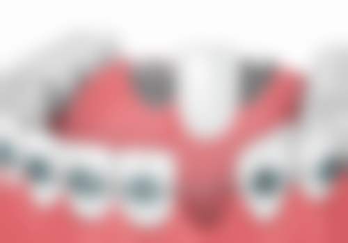 宝宝2岁地包天的营养补充