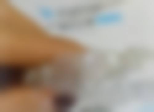 全瓷牙套可以做核磁共振吗？通常可直接检查，含金属桩核需提前告知医生