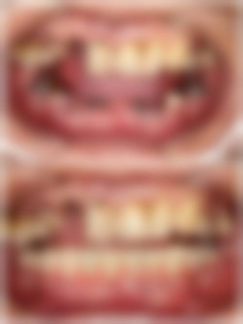 王大凯院长擅长项目