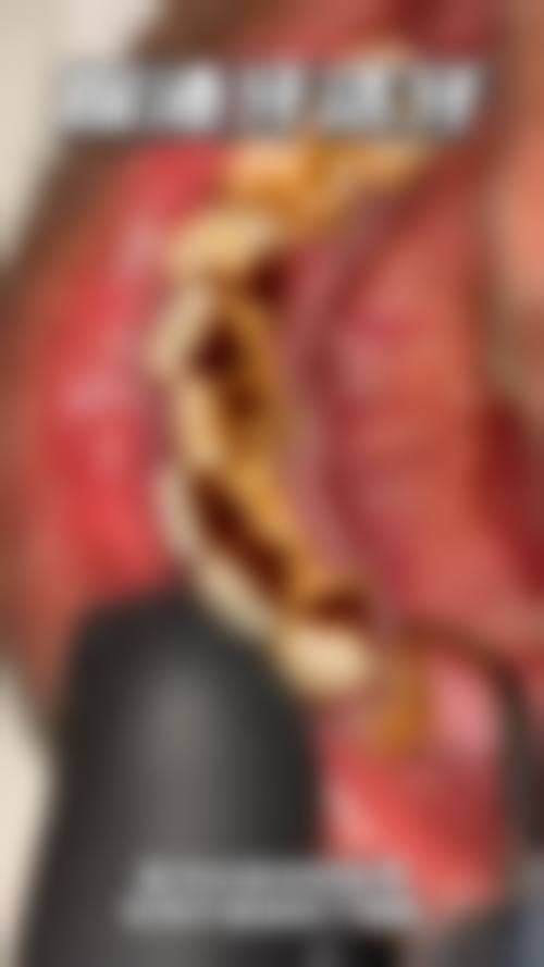 深圳泰康拜博园岭口腔是正规医院吗?