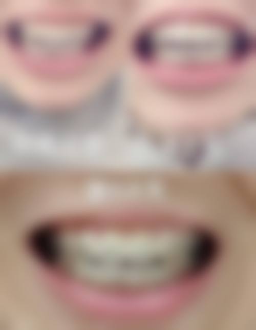 王大凯医生擅长项目