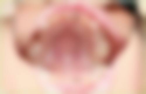 马鞍山儿牙24小时在线咨询：靠谱！麦芽儿等三家口腔设备先进，还能定制个性化方案！ 