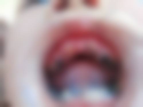 平湖钟埭杭成口腔门诊部:半口种植实力担当